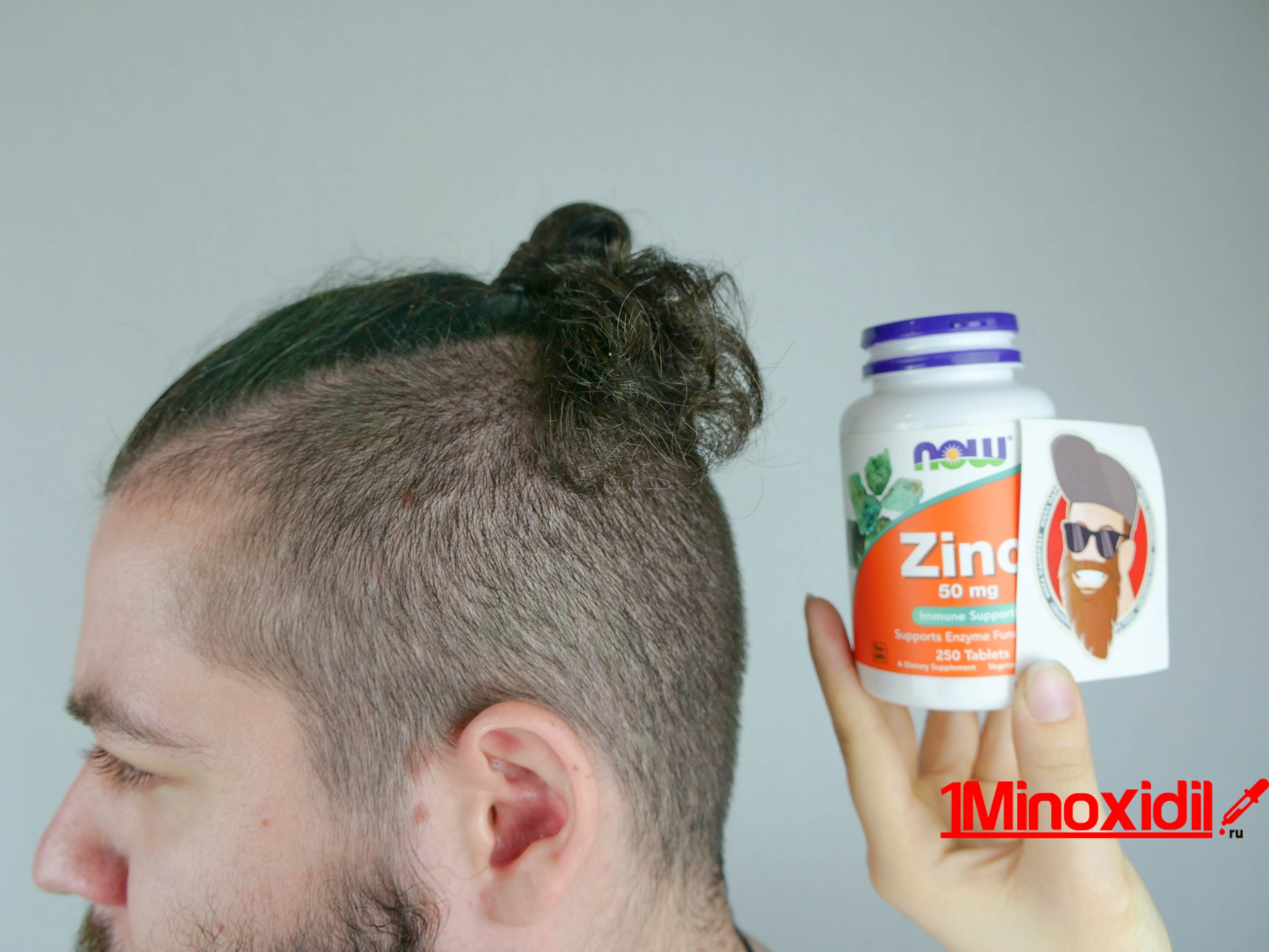 Какие витамины нужны для роста волос на голове у мужчин